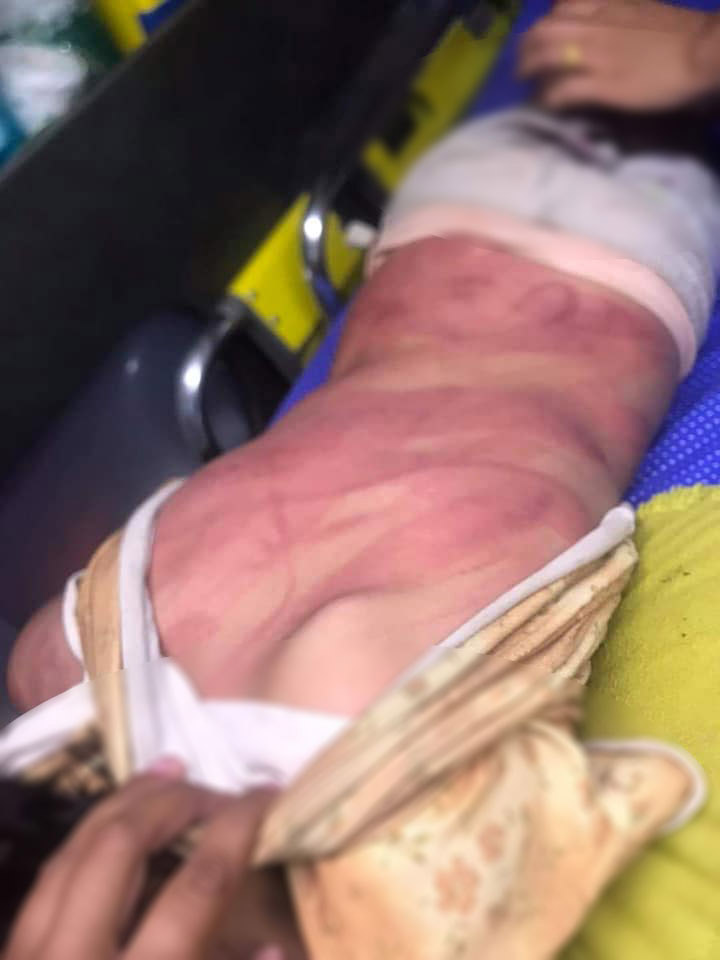 แม่ตีลูก