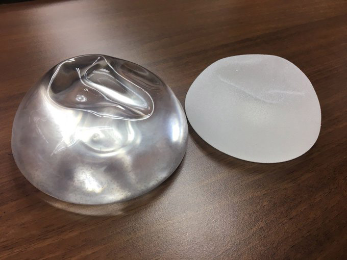 ซิลิโคนเสริมเต้านม