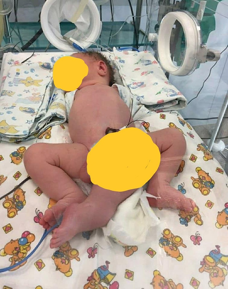 ทารกป่วย