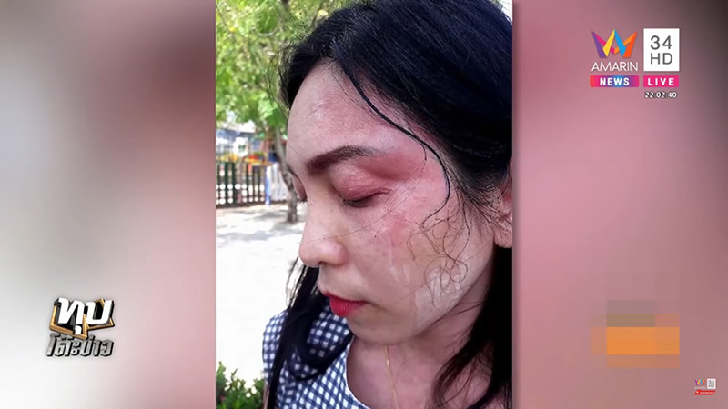 หนุ่มบีเอ็มต่อยครู