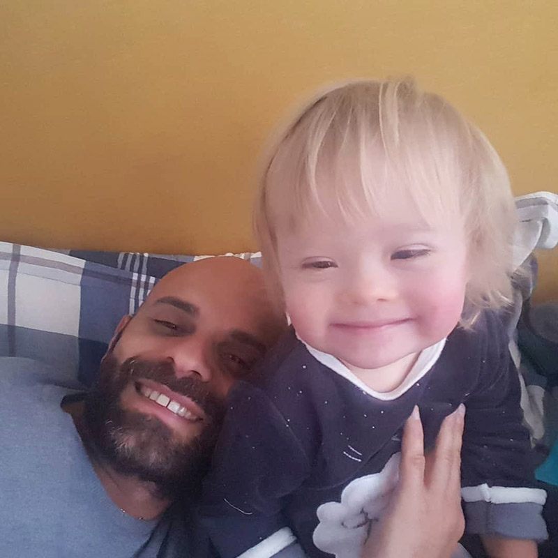 เด็กดาวน์ซินโดรม