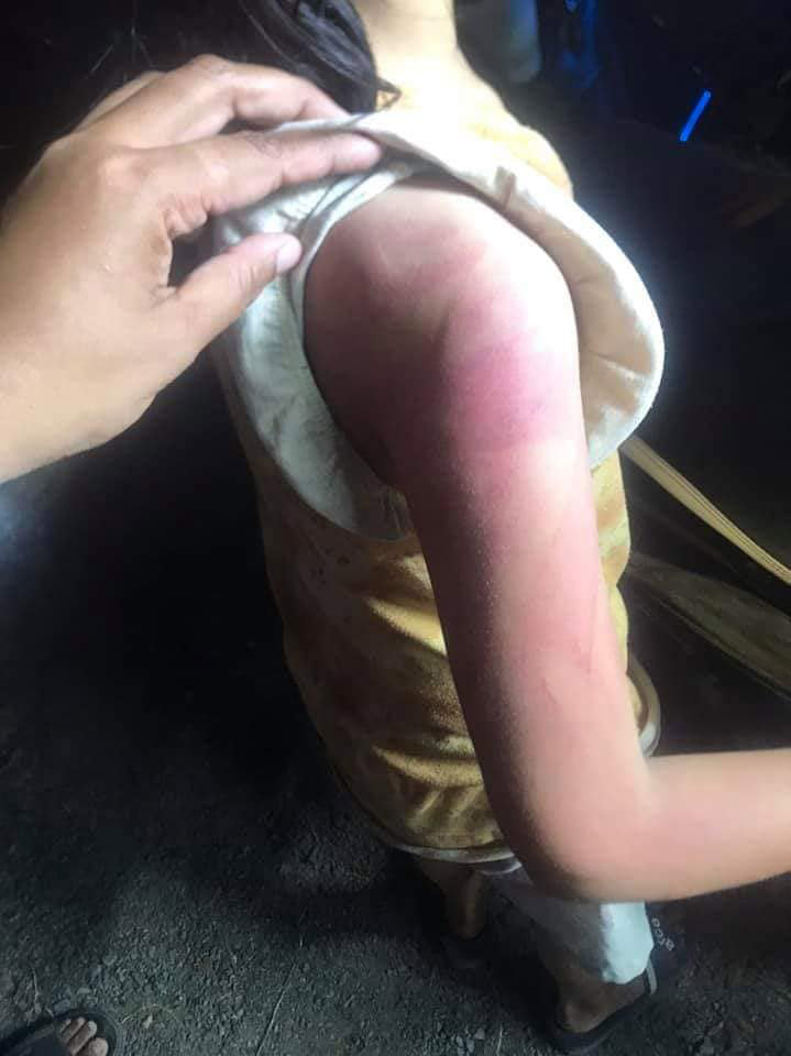 แม่ตีลูก