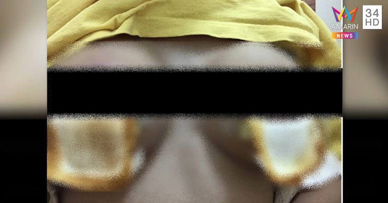 ศัลยกรรมทำพิษ