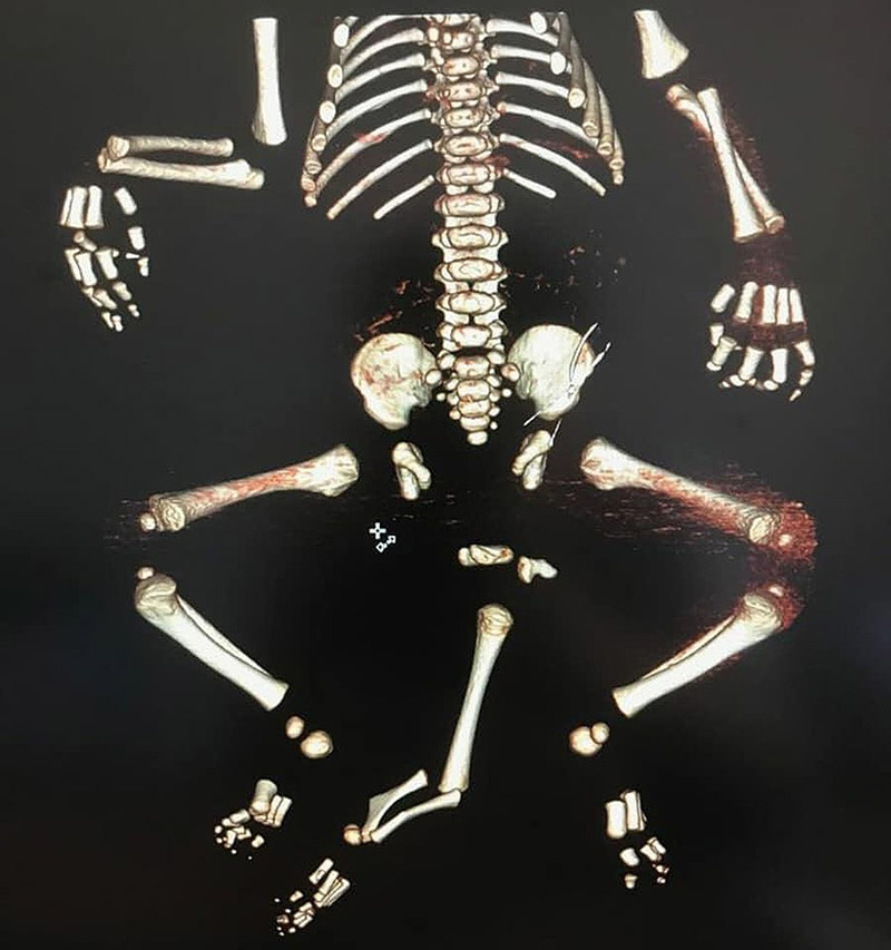 ทารกป่วย