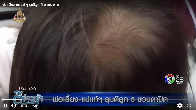 ทำร้ายเด็ก