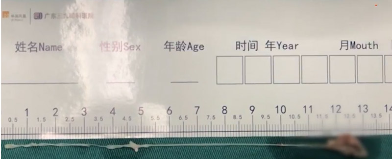 พยาธิในสมอง