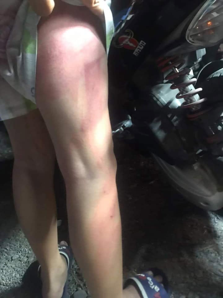 แม่ตีลูก