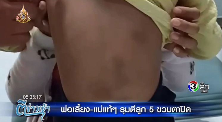 ทำร้ายเด็ก