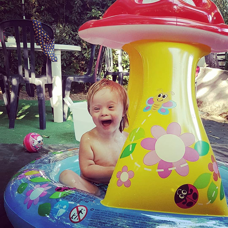 เด็กดาวน์ซินโดรม