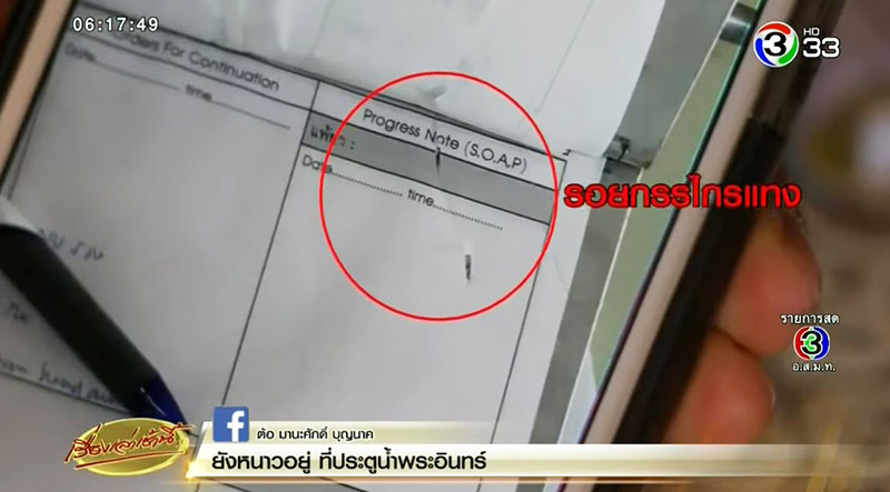 คนไข้แทงหมอ