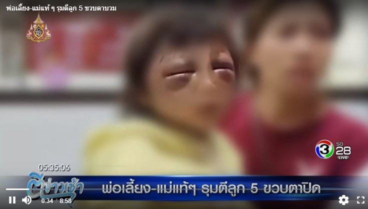 ทำร้ายเด็ก