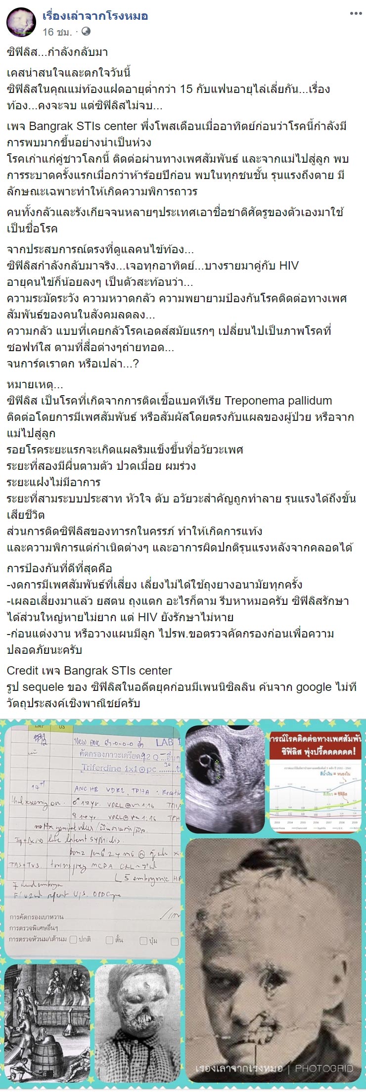 โรคซิฟิลิส