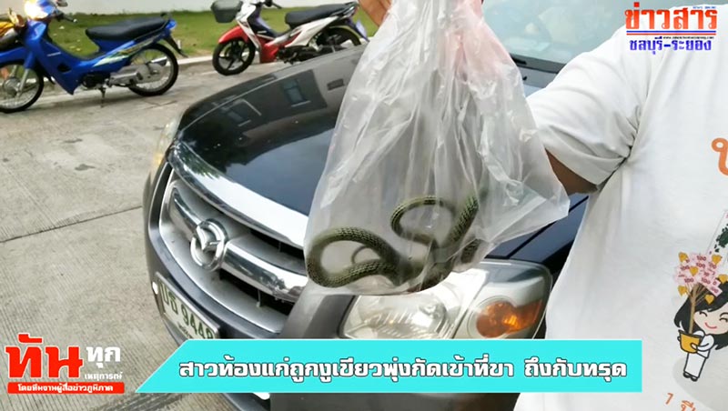 งูกัด