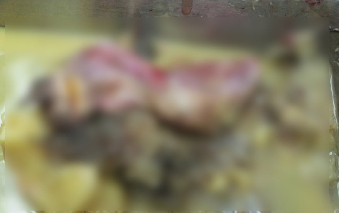 ปวดท้อง