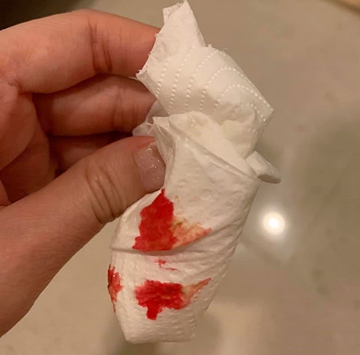   ได๋ ไดอาน่า 