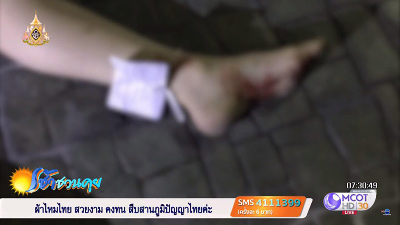 นางแบบฆ่าตัวตาย