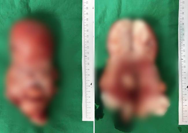 สาวชอบกินส้มตำเผ็ด ๆ