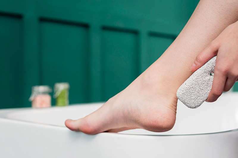 ส้นเท้าแตก