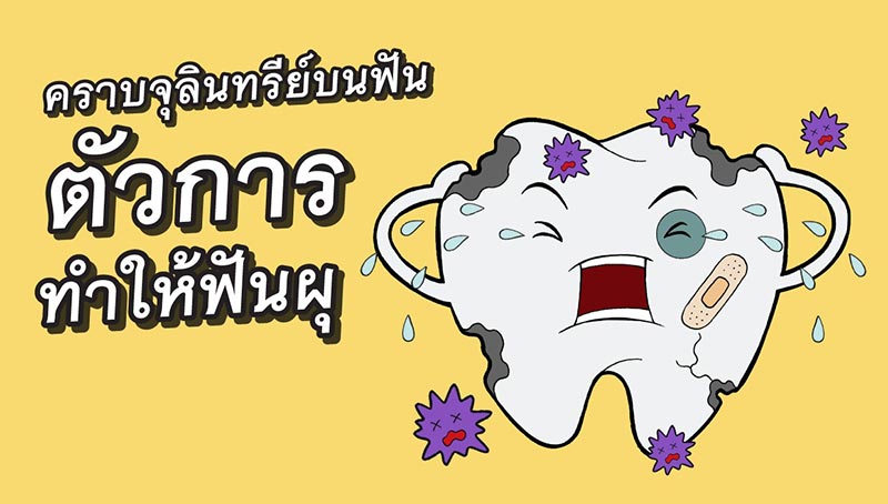 ฟันผุ