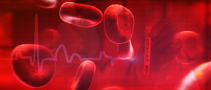 ติดโควิดซ้ำ 