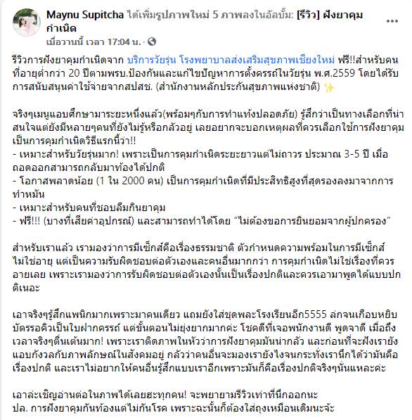 สาวแชร์ประสบการณ์ รีวิวฝังยาคุม