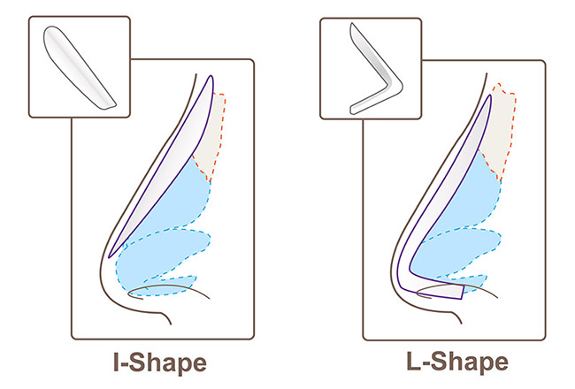 เสริมซิลิโคนจมูก