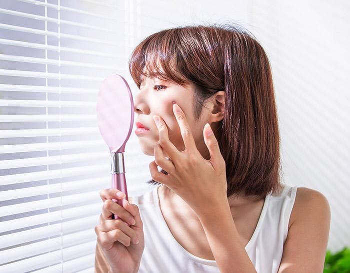 วิธีรักษาสิว