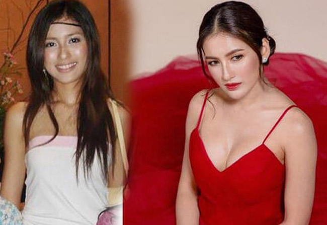 ดาราทำหน้าอก