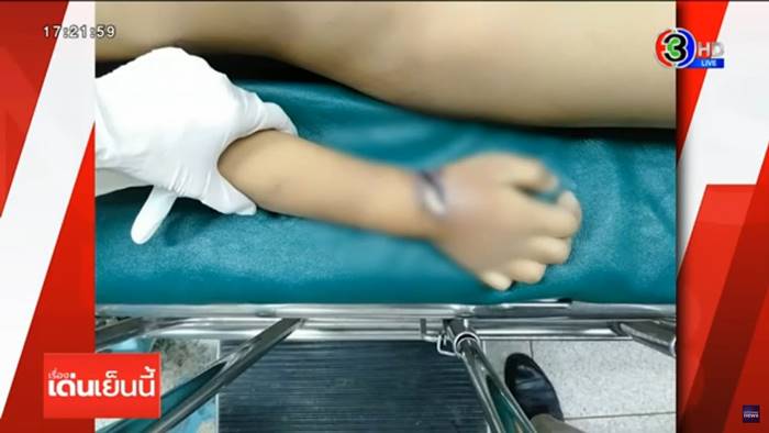 พ่อเลี้ยงทำร้ายลูกเลี้ยง