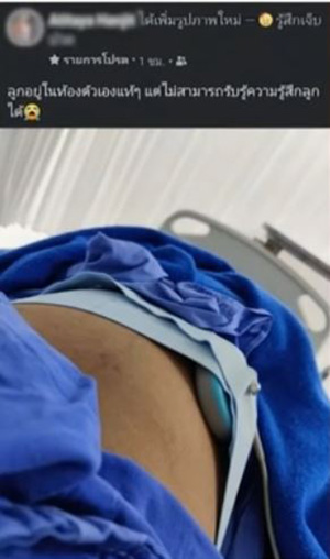 สาวท้อง 7 เดือน แท้งลูก ไม่กี่ชม. หลังฉีดไฟเซอร์