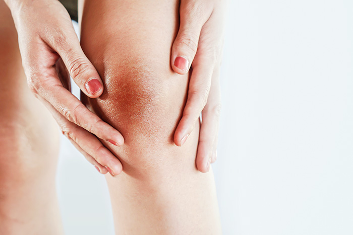 วิธีแก้ข้อศอกดํา เข่าดํา