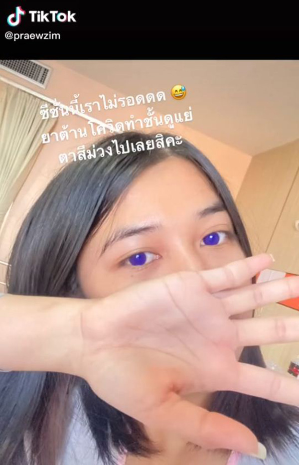 สาวติดโควิด กินยาฟาวิพิราเวียร์ ตาเปลี่ยนสี