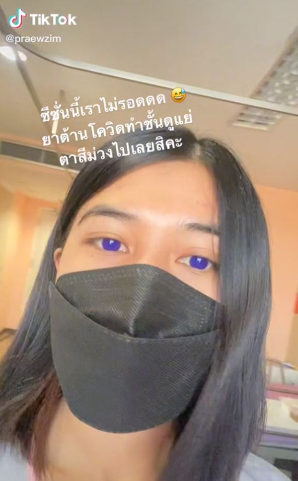 สาวติดโควิด กินยาฟาวิพิราเวียร์ ตาเปลี่ยนสี