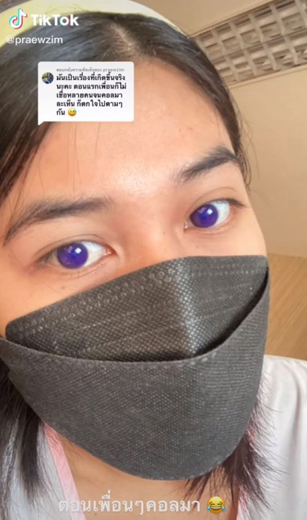 สาวติดโควิด กินยาฟาวิพิราเวียร์ ตาเปลี่ยนสี