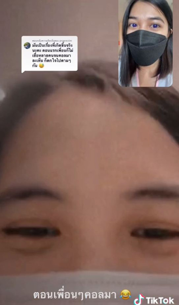 สาวติดโควิด กินยาฟาวิพิราเวียร์ ตาเปลี่ยนสี