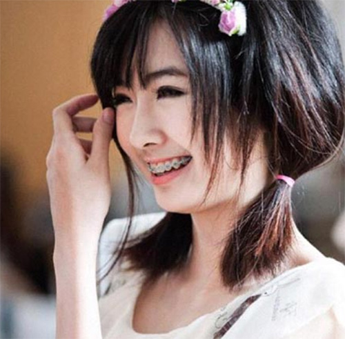 เบียร์ เดอะวอยซ์