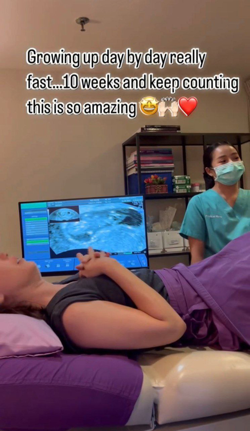 เฟม ภีมเดช ประกาศข่าวดี แมท ภีรนีย์ ท้องแล้ว 3 เดือน 