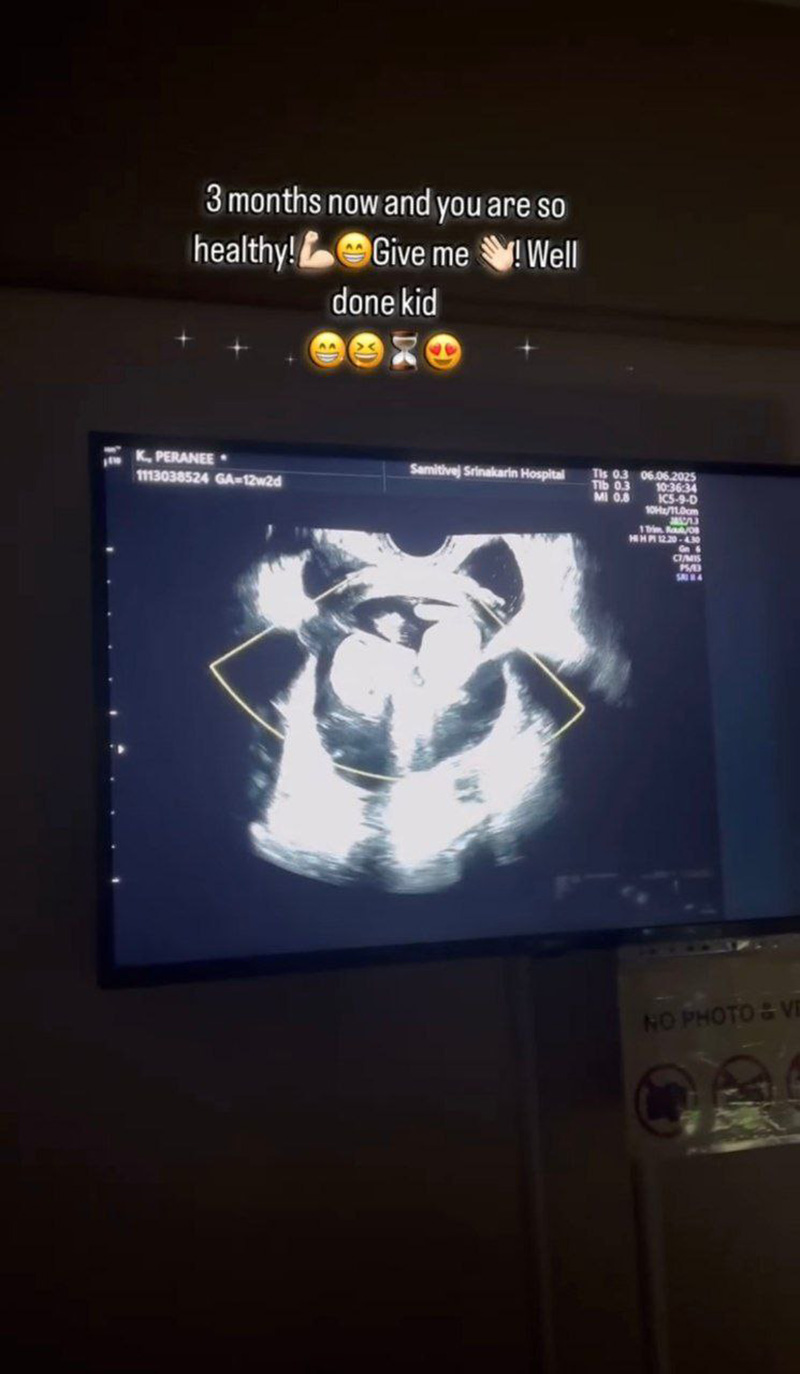 เฟม ภีมเดช ประกาศข่าวดี แมท ภีรนีย์ ท้องแล้ว 3 เดือน 