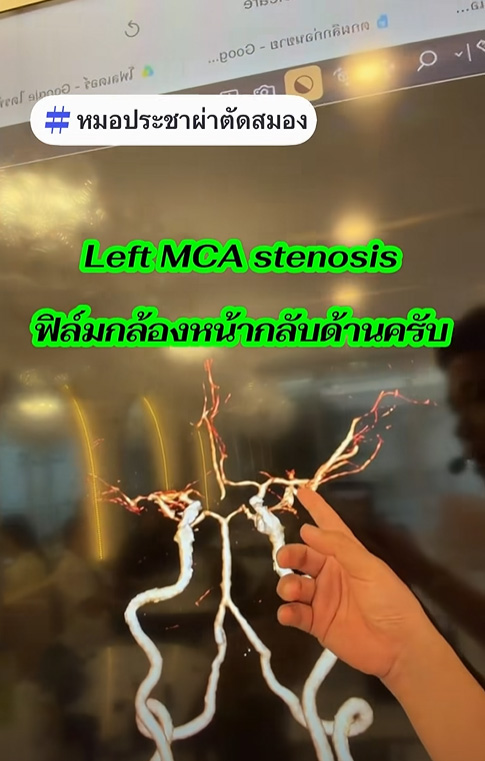นึกชื่อของไม่ออก