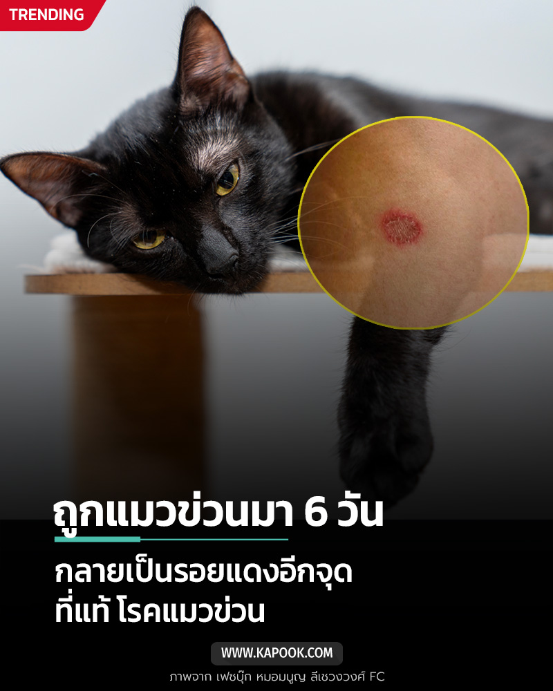 โรคแมวข่วน
