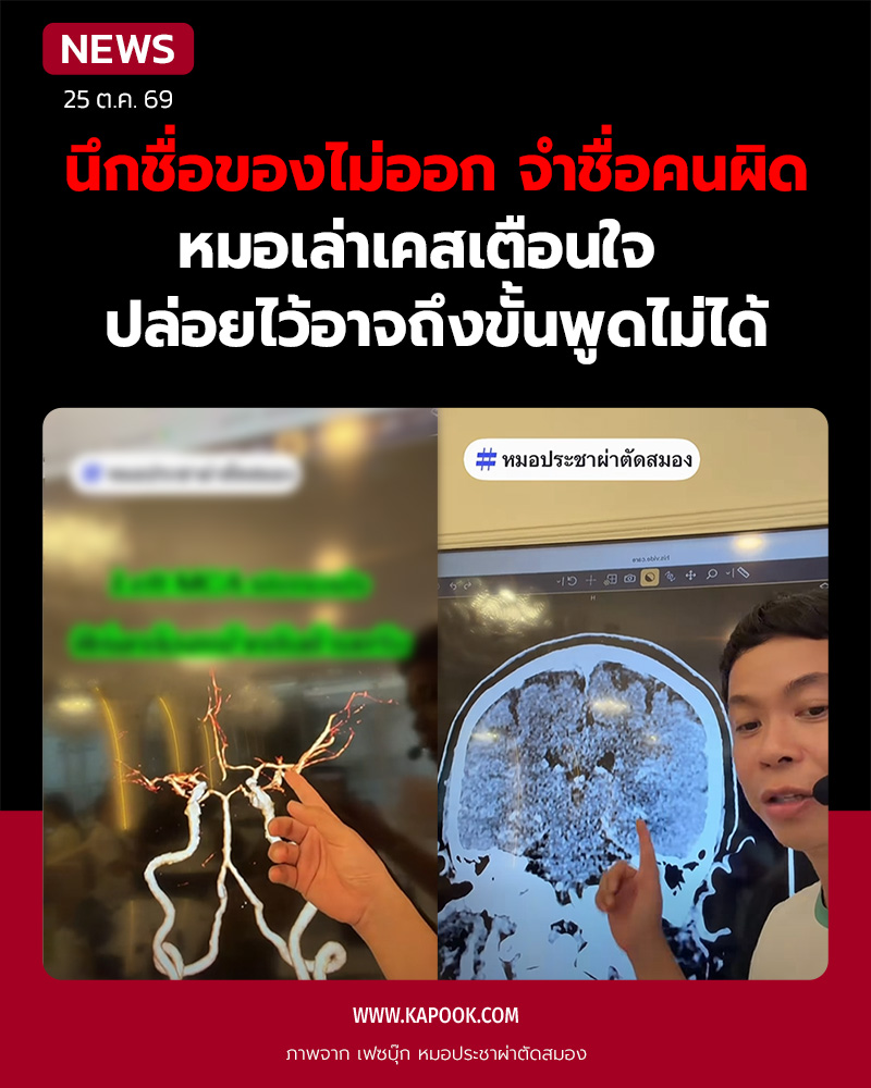 นึกชื่อของไม่ออก