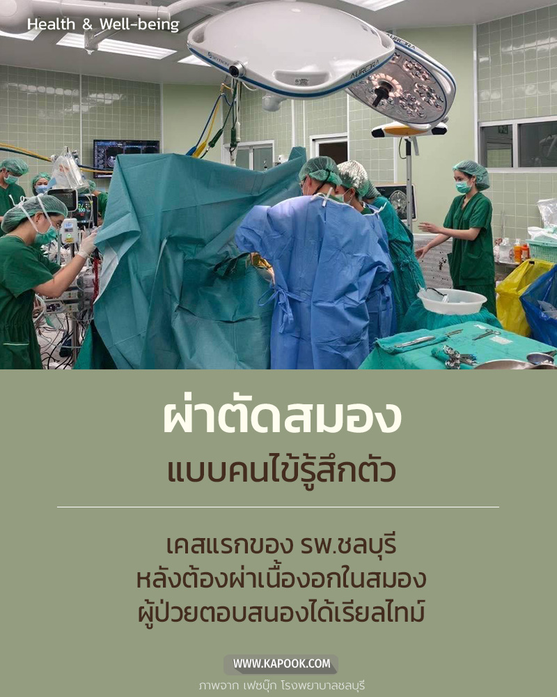 ผ่าตัดสมอง