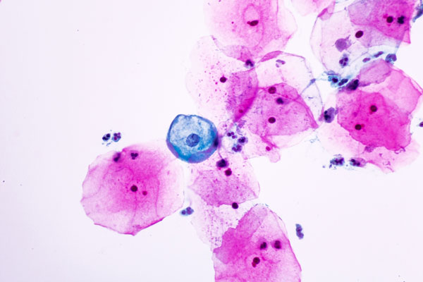 ไวรัสนิปาห์