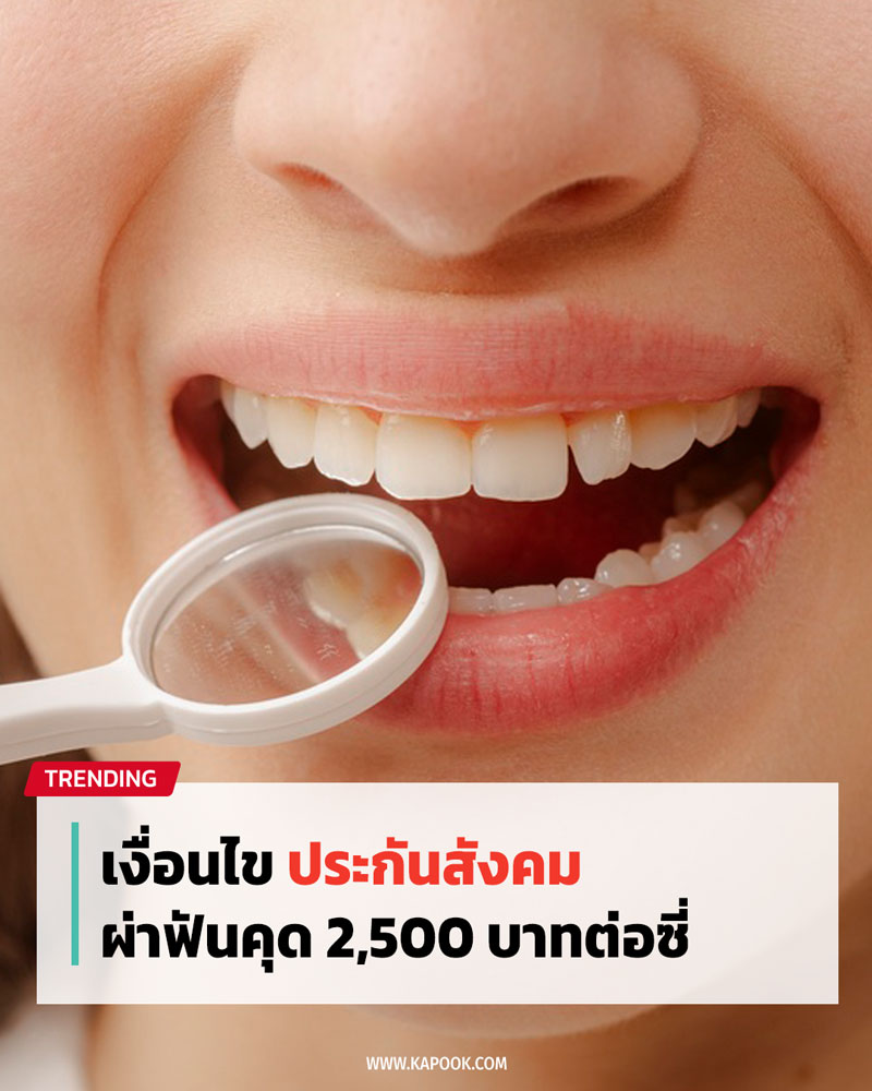 ผ่าฟันคุด