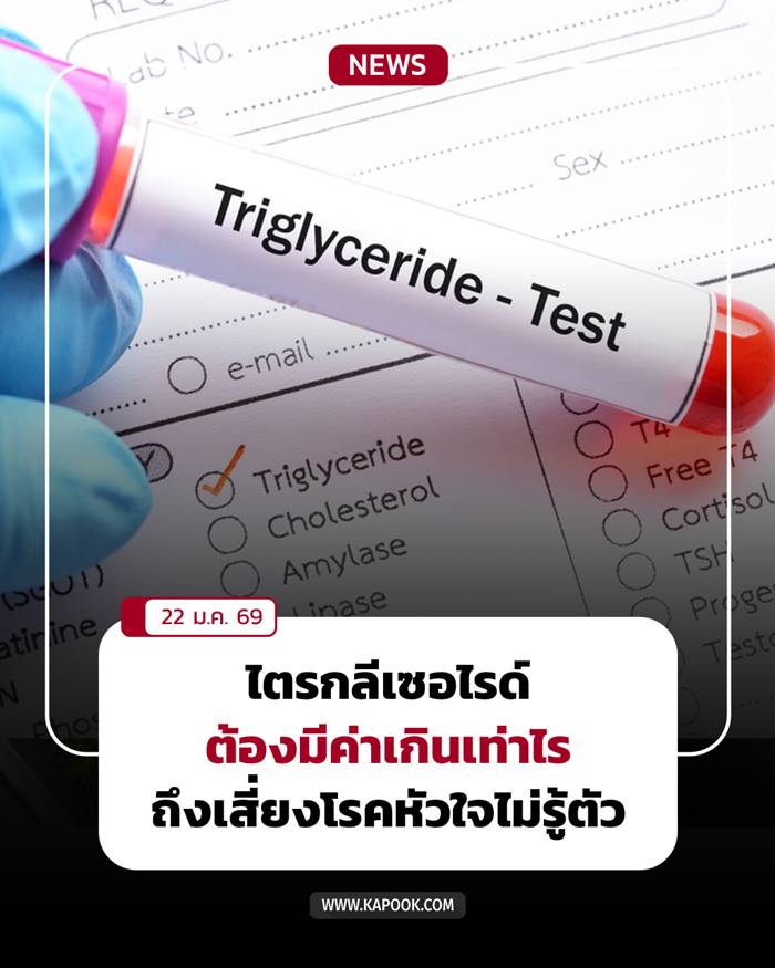 ไตรกลีเซอไรด์