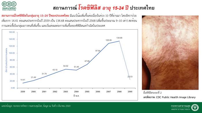 ซิฟิลิสวัยรุ่นไทยพุ่ง