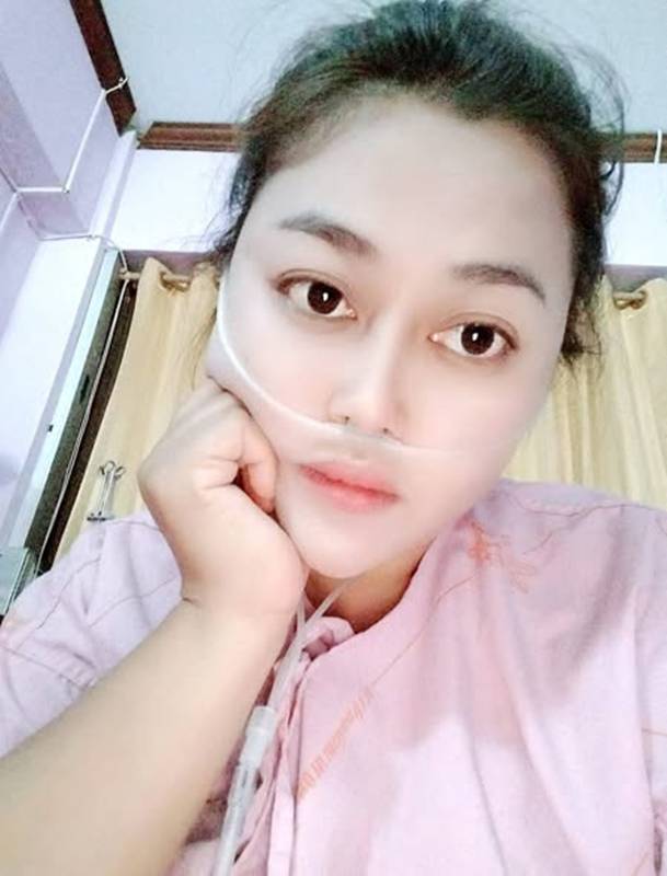 โรคหลอดเลือดสมอง