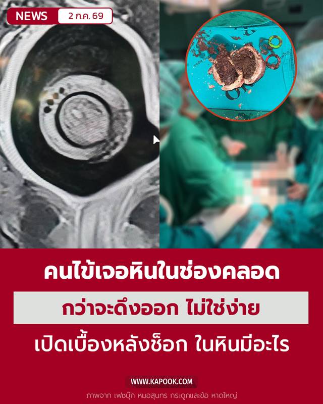 ผ่าตัด
