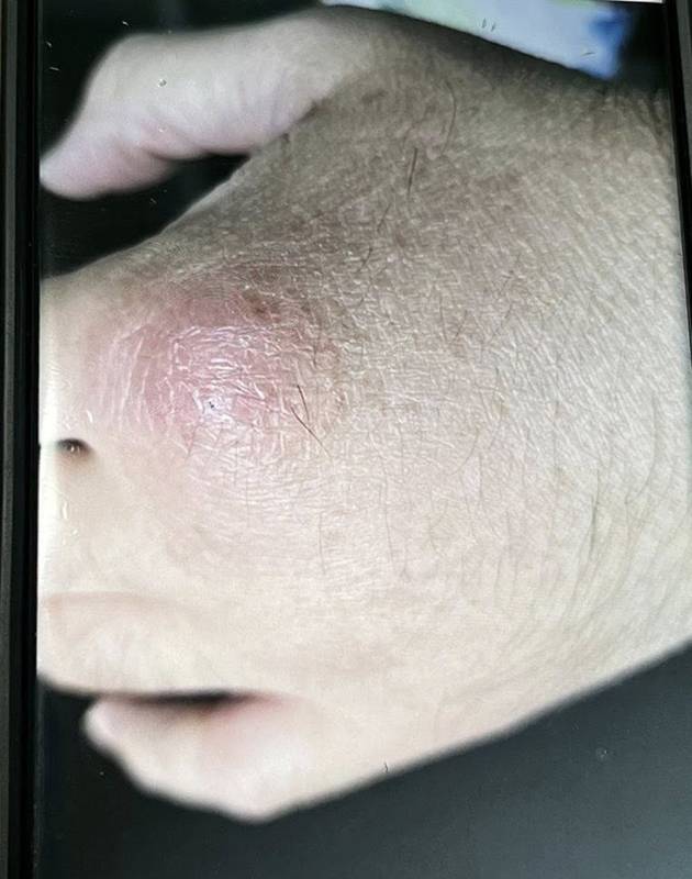 เชื้อราแมว