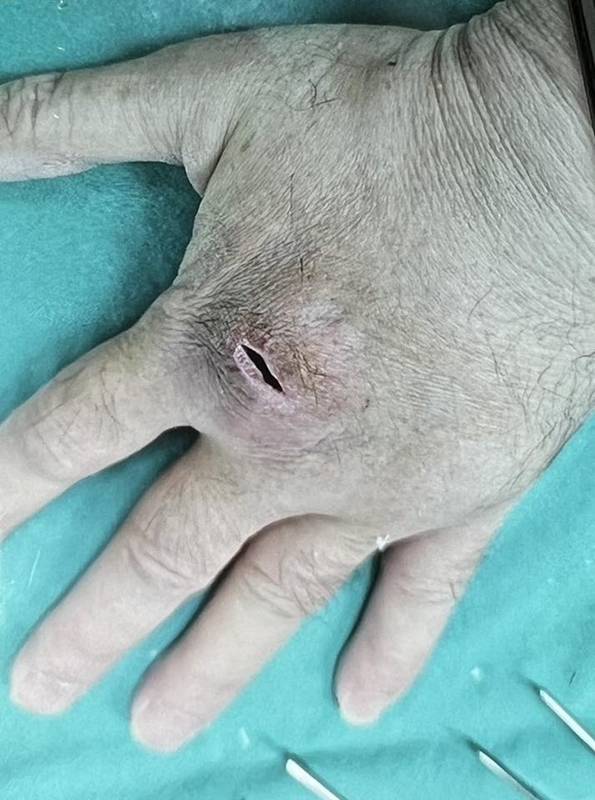 เชื้อราแมว